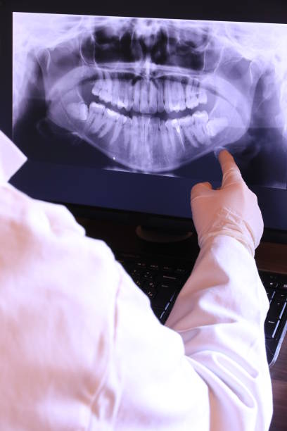 Best Emergency Treatment for Dental Infections or Abscesses in Harriman, TN